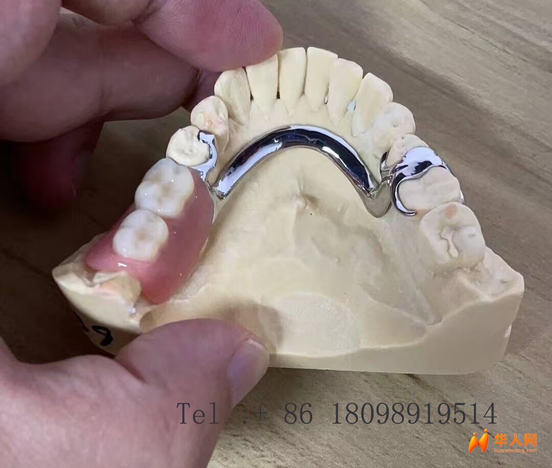 定制义齿出口厂家 外贸义齿加工厂 专业假牙出口工厂 种植牙外贸供应商