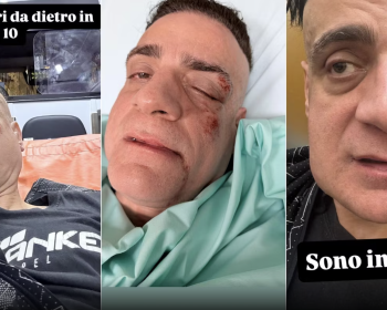 罗马反扒网红在地铁里遭十人偷袭围殴，被打的鼻青脸肿！