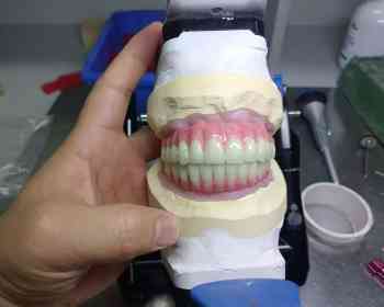 FDA注册米兰出口认证 罗马义齿加工厂 假牙厂家