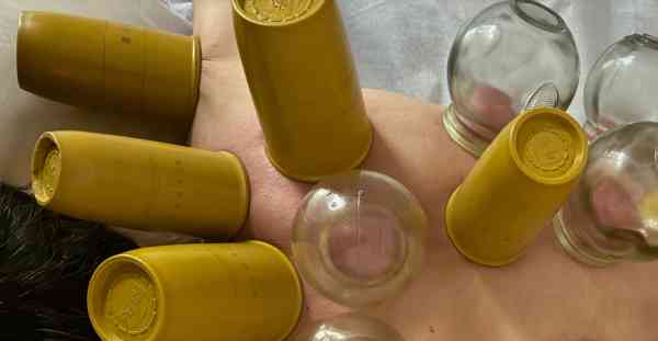 本店主要项目：精雕修脚，足疗，针灸，推拿，刮痧，拔罐，放血，