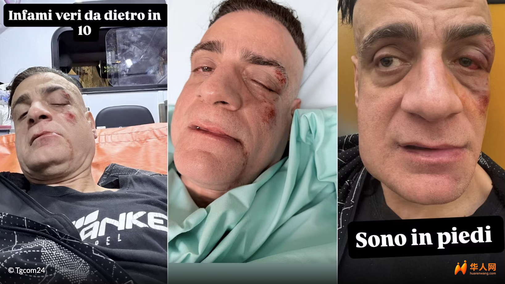 罗马反扒网红在地铁里遭十人偷袭围殴，被打的鼻青脸肿！